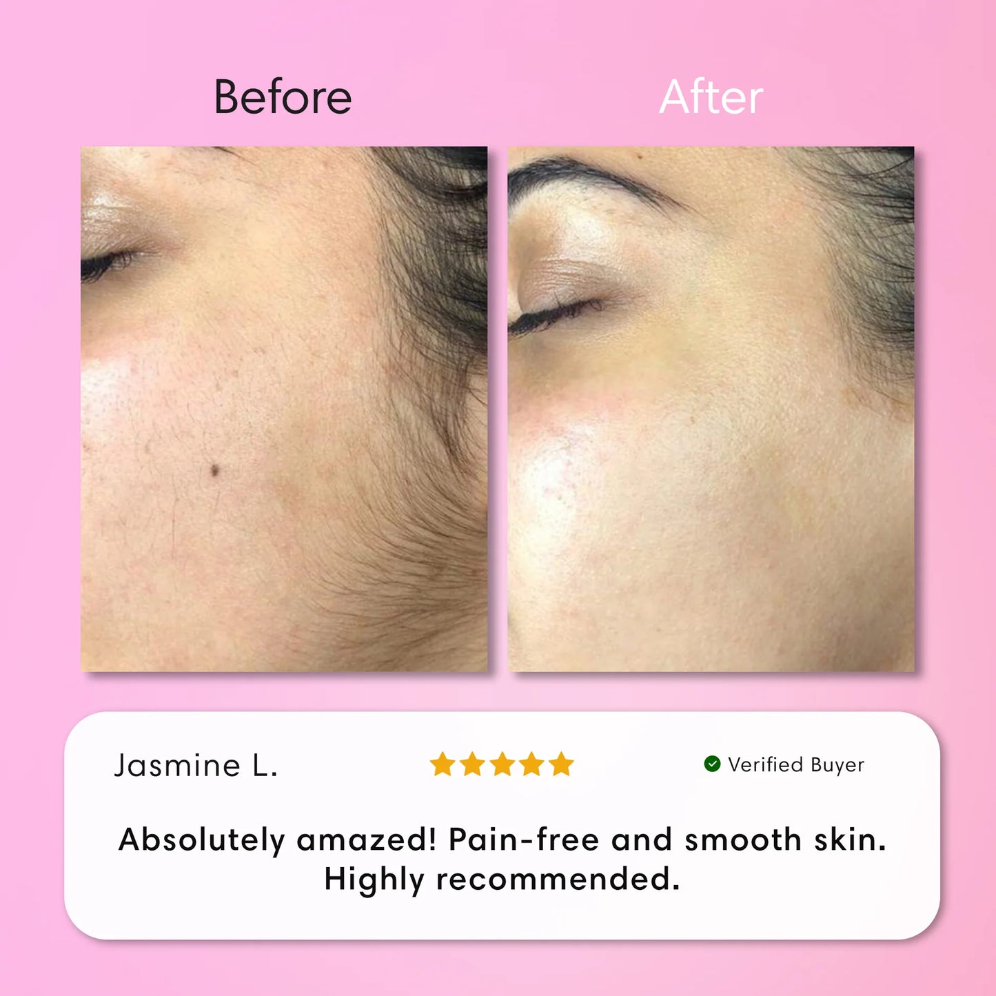 Instant Hair Removal Kit
