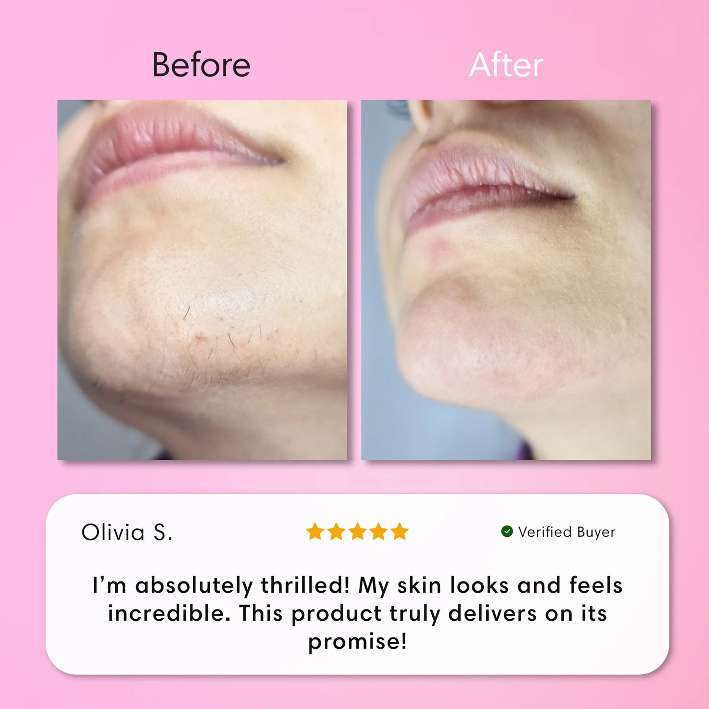 Instant Hair Removal Kit