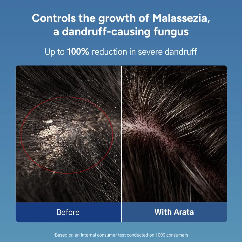Arata Anti-Dandruff Shampoo, Tonic, Free Conditioner Combo