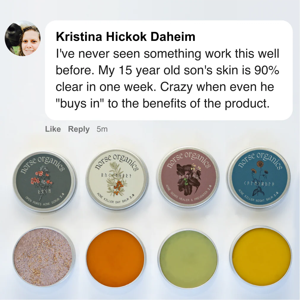 The Complete Acne Killer System 2.0