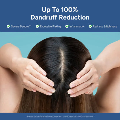 Arata Anti-Dandruff Shampoo, Tonic, Free Conditioner Combo